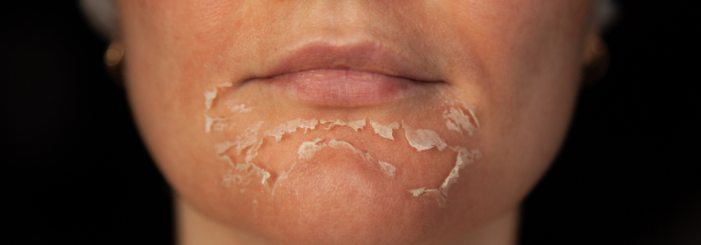 Peeling aux Algues Zena Lyon : La Révolution Naturelle pour une Peau Sublimée