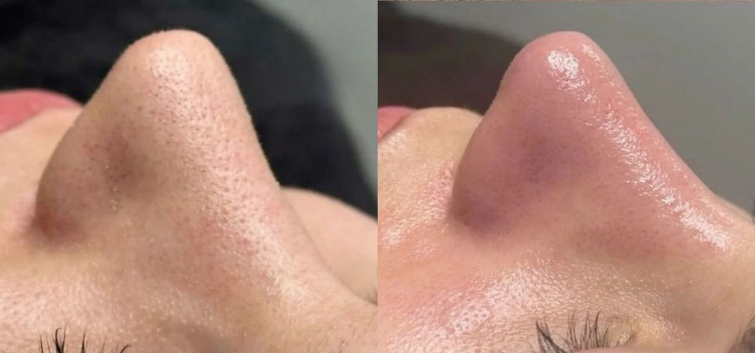 Eclaire De beauté