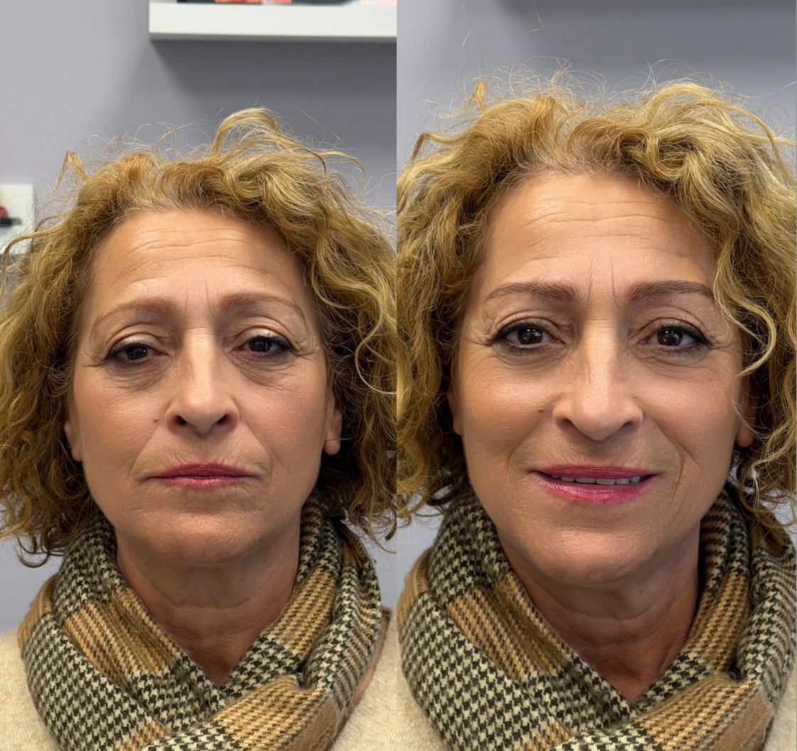Eclaire De beauté