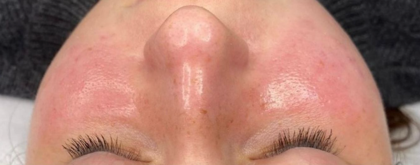 Peau_apres_soin_Hydraface_nettoyage_en_profondeur_Givors-10-22_a_12.28.38