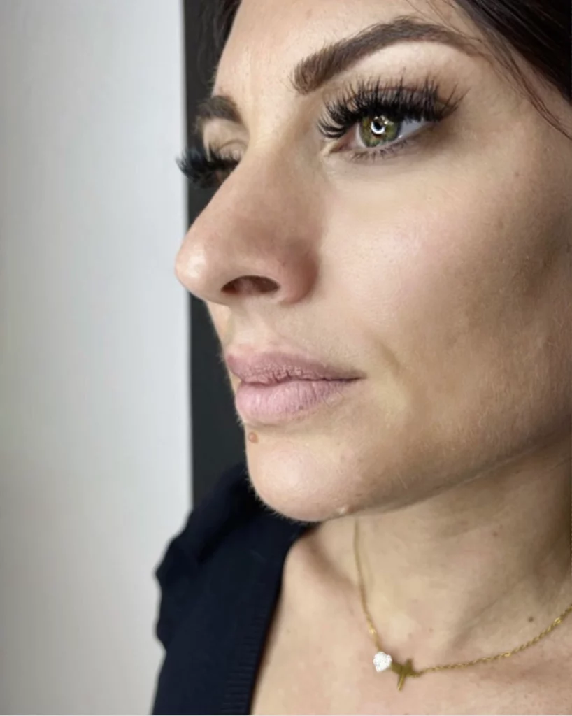 Avant maquillage permanent des lèvres Aquarelle Lips