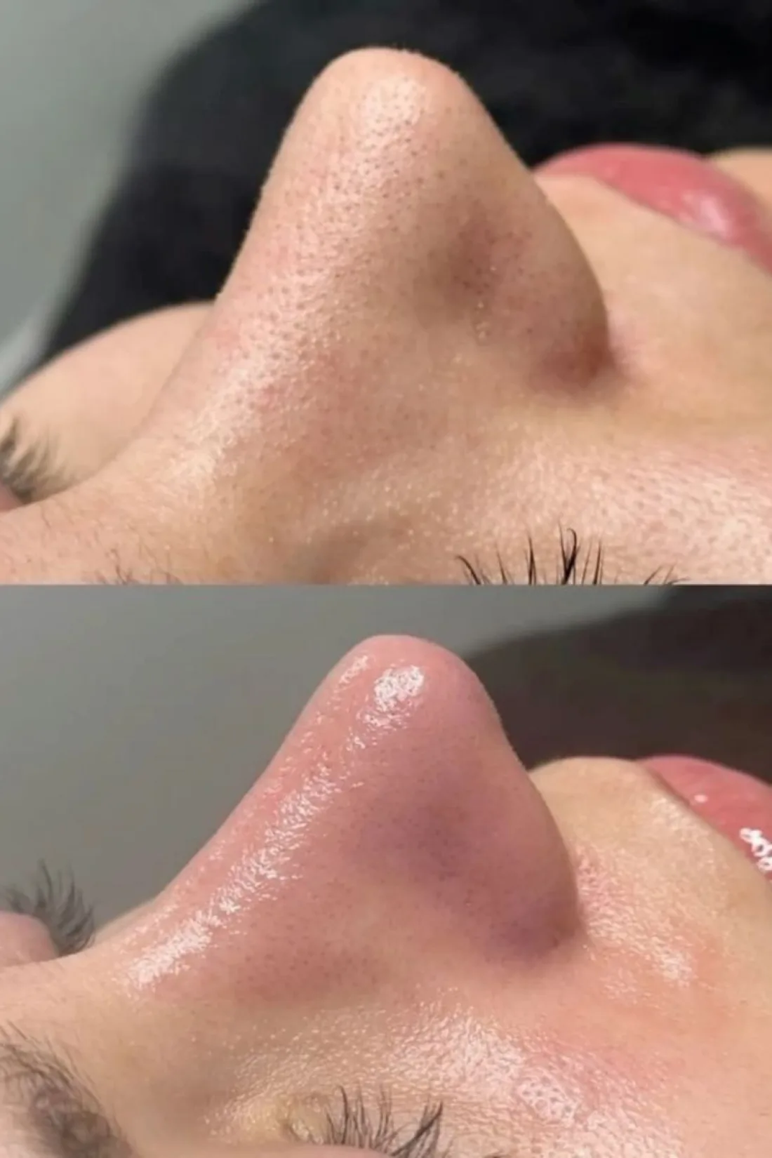 Réalisations de Claire en soin du visage Hydraface, photo 1 sur 4