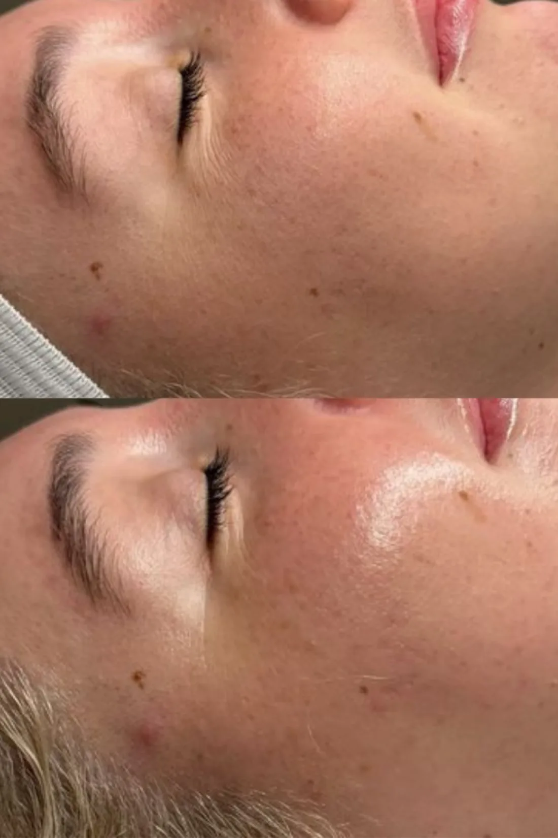 Réalisations de Claire en soin du visage Hydraface, photo 2 sur 4