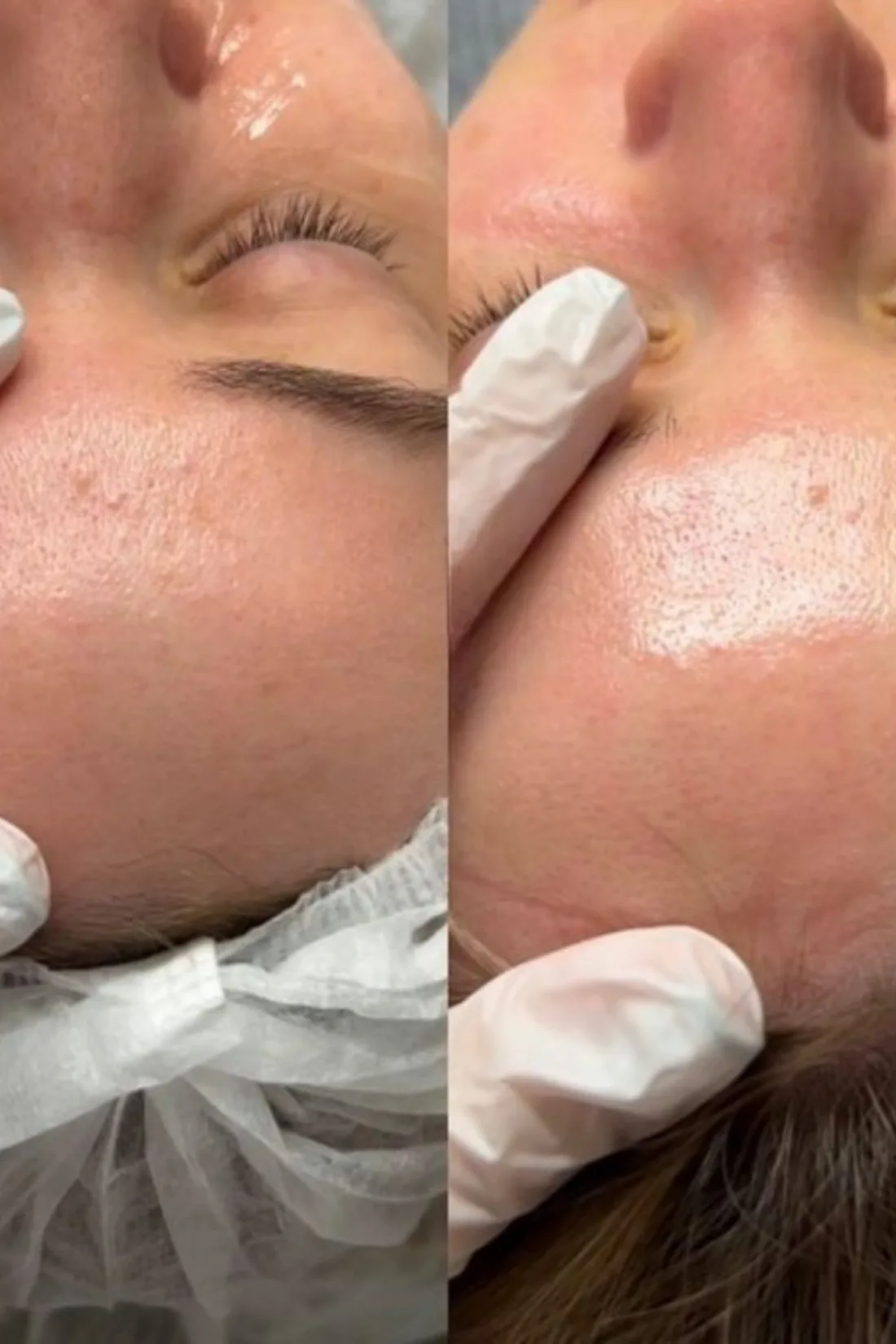 Réalisations de Claire en soin du visage Hydraface, photo 3 sur 4