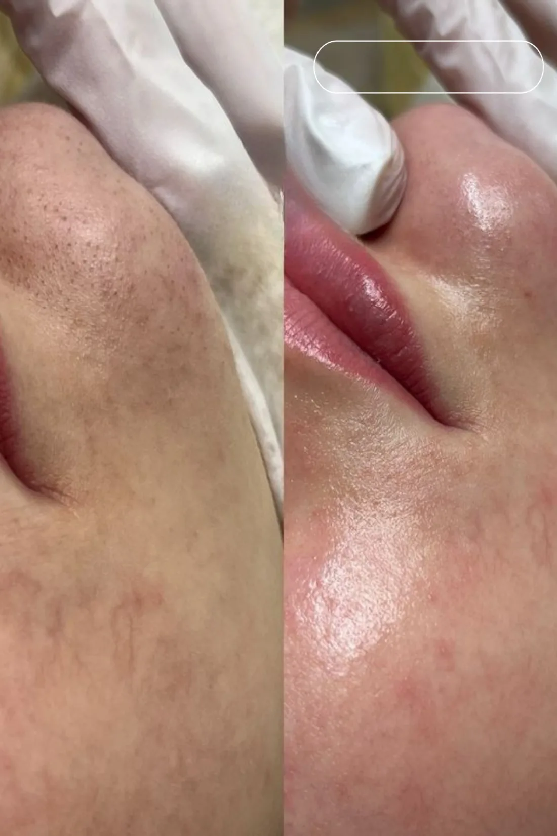 Réalisations de Claire en soin du visage Hydraface, photo 4 sur 4