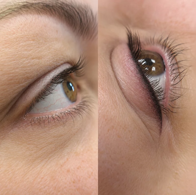 Eye-liner permanent : avant et après, ligne de cils soulignée