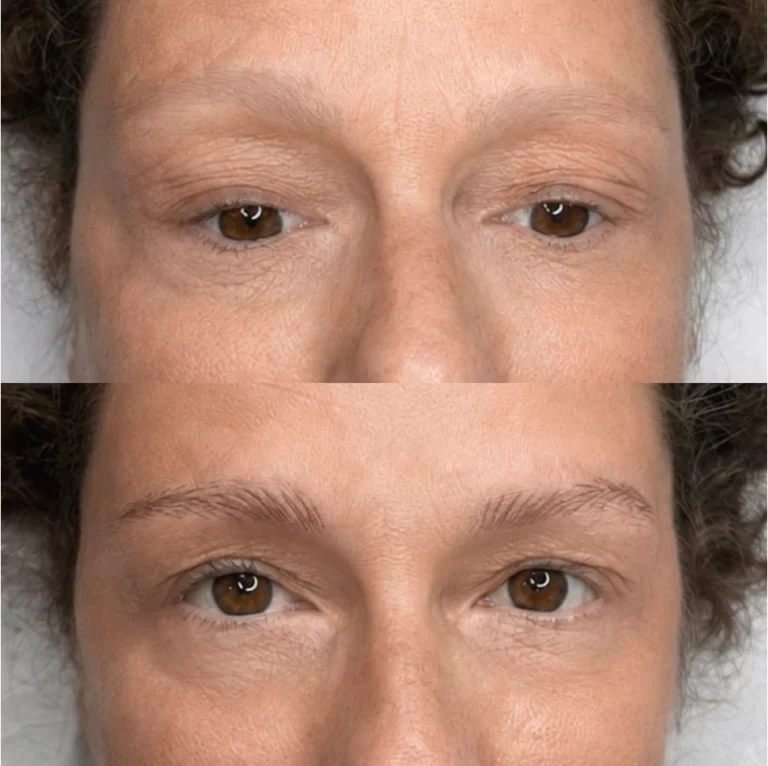 Sourcils poil-à-poil : avant et après, ligne redessinée sur un sourcil clairsemé